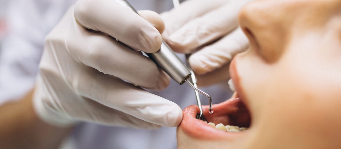 Cannon Hill Dental Experts